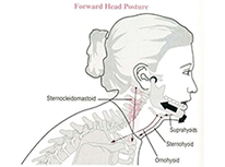 顳下頜關(guān)節(jié)疾病